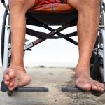 Penyakit Polio Sering Terjadi Pada Anak Di Bawah 5 Tahun