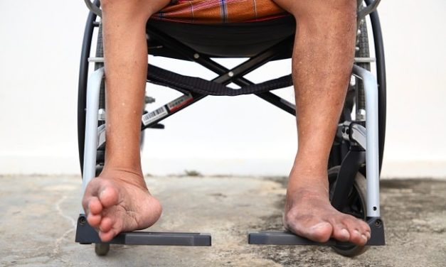 Penyakit Polio Sering Terjadi Pada Anak Di Bawah 5 Tahun