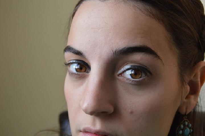 Penyebab Utama Lingkaran Hitam Pada Mata Karena Kurang Tidur