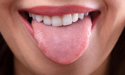 Glositis Bisa Terjadi Pada Siapa Saja, Ini Dia Gejala Dan Solusinya