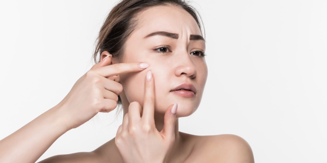 Hilangkan Bekas Jerawat Membandel Dengan Bahan Skincare Ini
