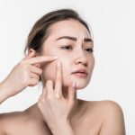 Hilangkan Bekas Jerawat Membandel Dengan Bahan Skincare Ini