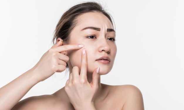 Hilangkan Bekas Jerawat Membandel Dengan Bahan Skincare Ini