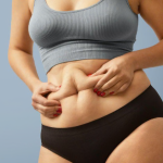 Mengenal PCOS Belly, Gejala, Penyebab Serta Tips Mengatasinya