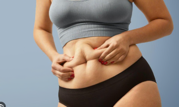 Mengenal PCOS Belly, Gejala, Penyebab Serta Tips Mengatasinya
