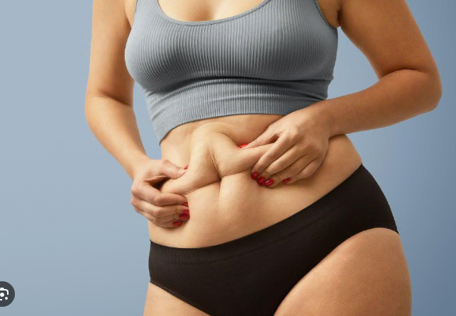 Mengenal PCOS Belly